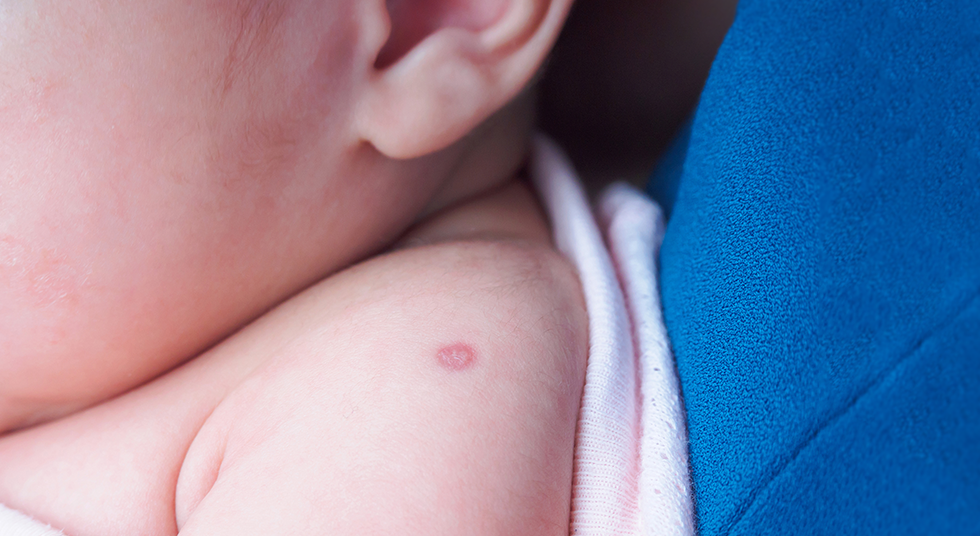 Vacina BCG: a sua importância na primeira fase da vida dos bebês