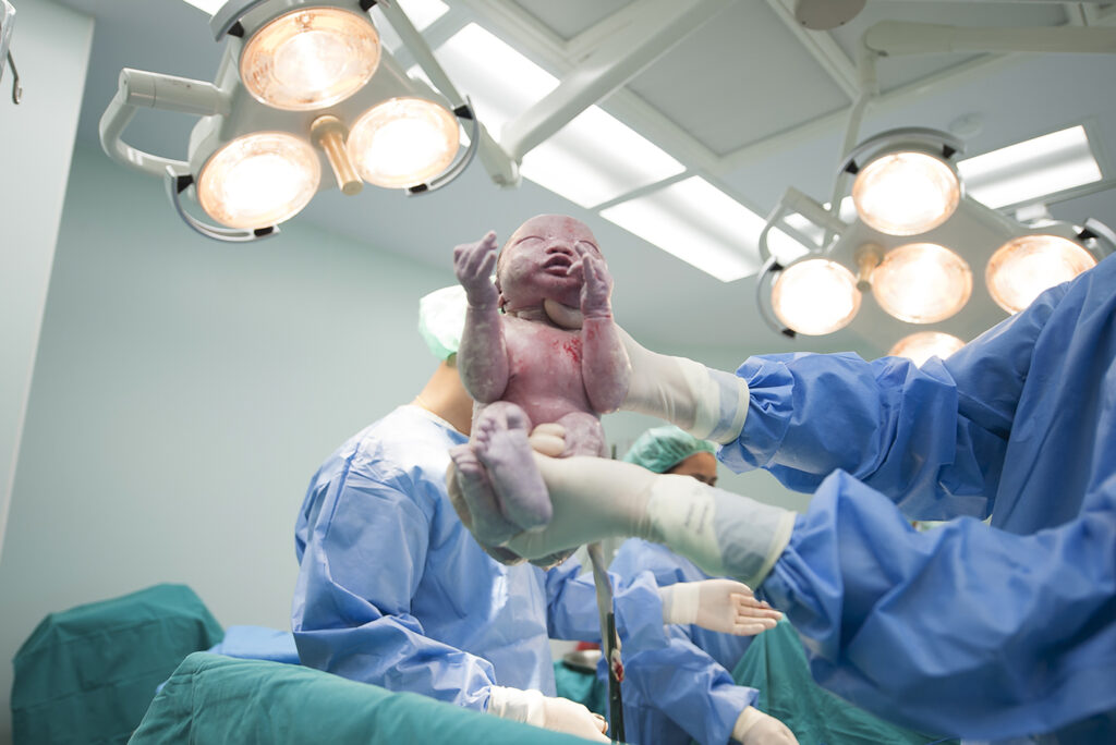 Nascimento do bebê via cesariana