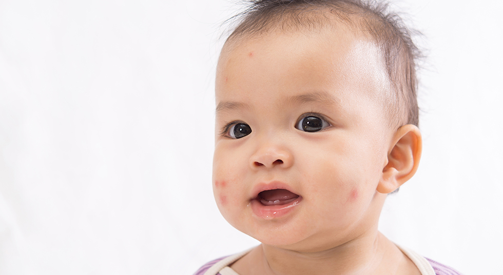 Como proteger o bebê de picadas de mosquitos