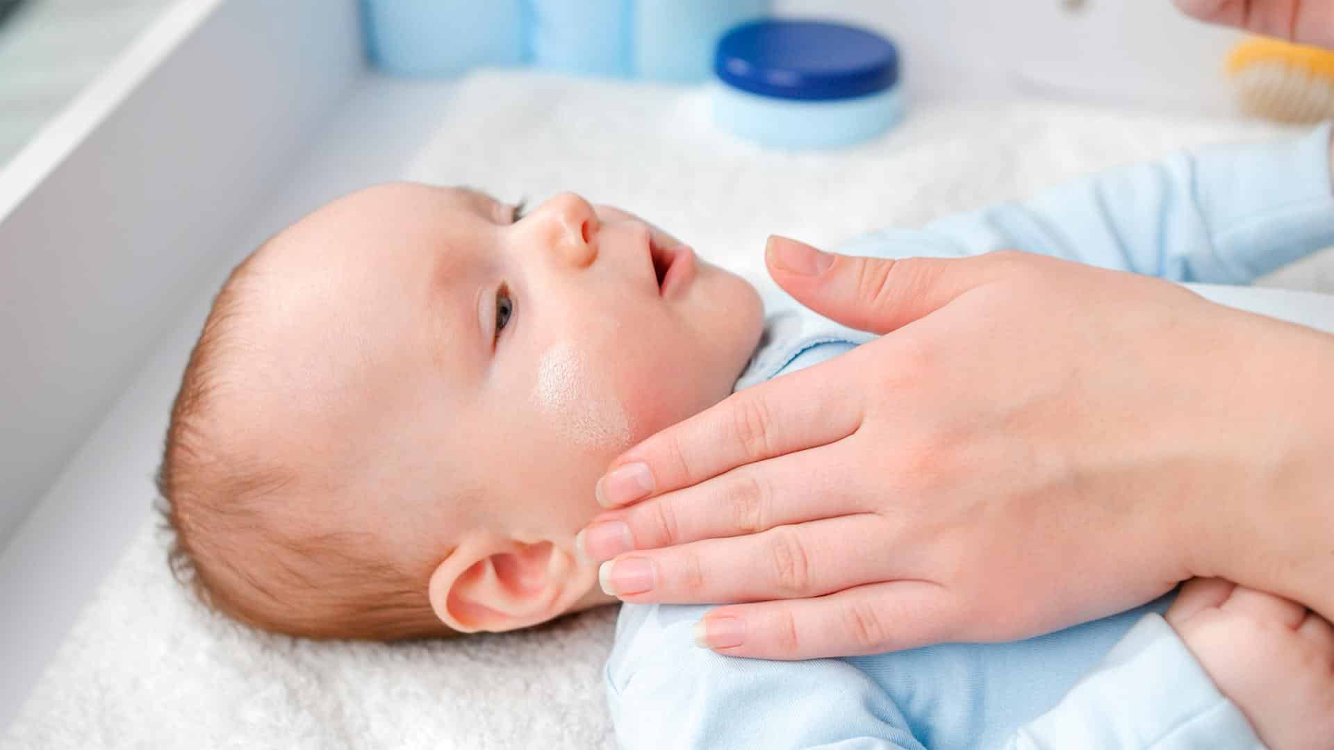 Talco em regiões afetadas pela alergia