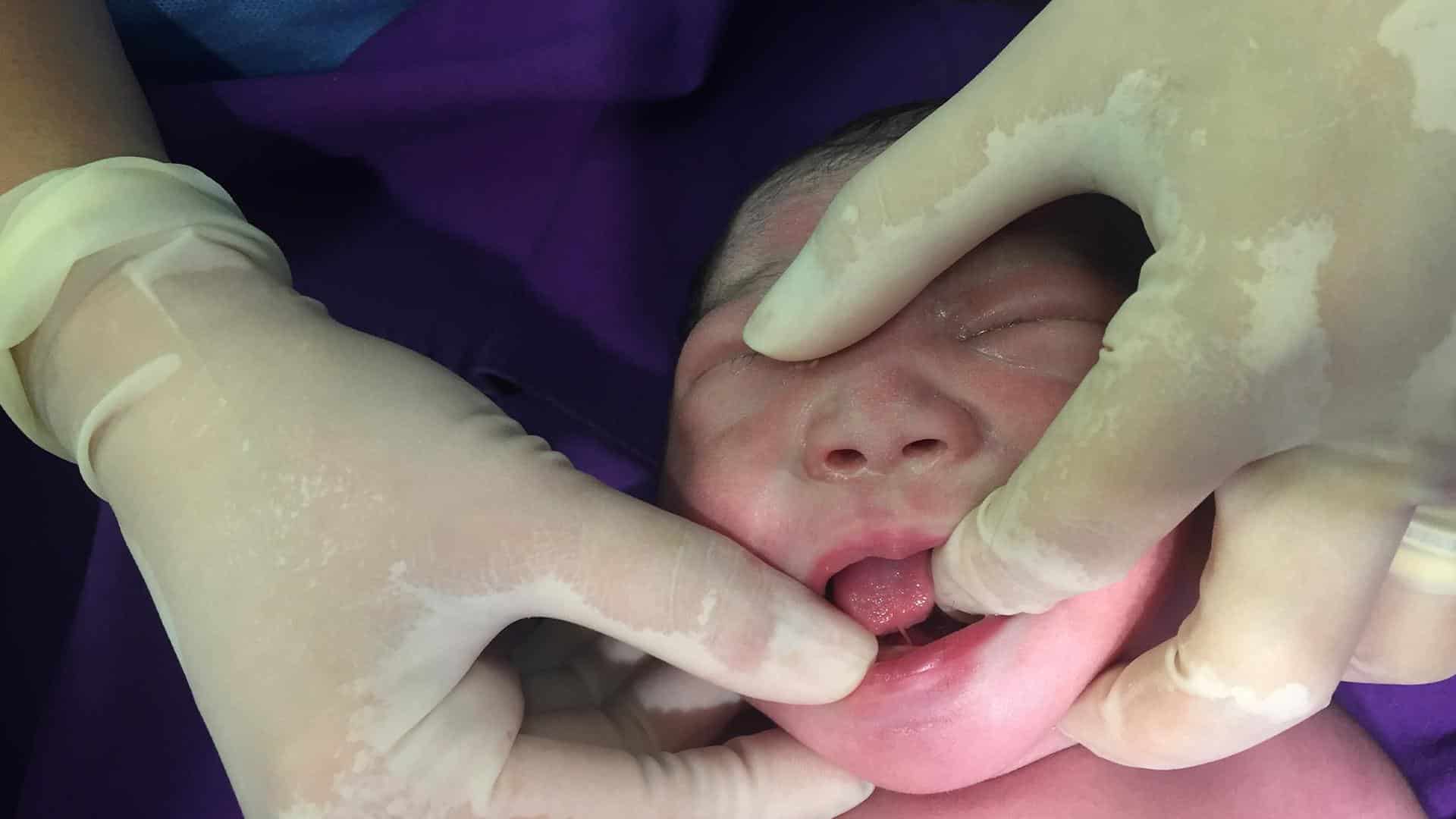 Médico examinando língua do bebê